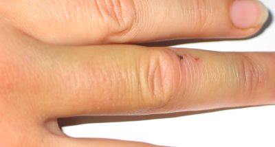 finger 3
